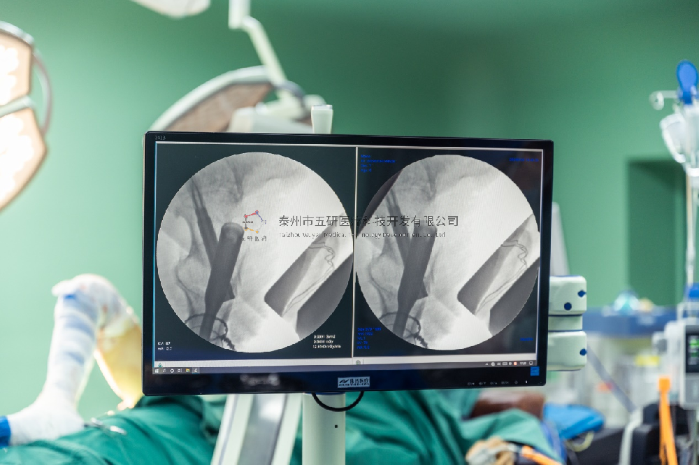 強(qiáng)直性脊柱炎既往病史，股骨粗隆下骨折